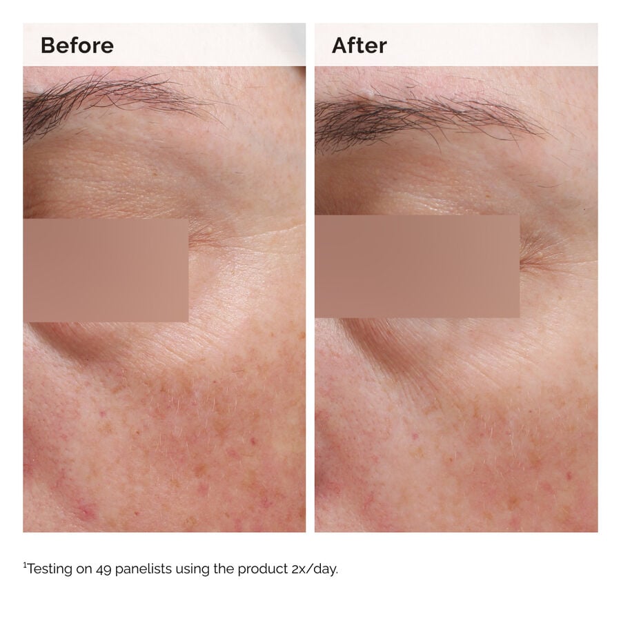 niacinamide-5-face-and-body-emulsion-t0 2024-08-23-ORD-Nia-5pct-Face-Body-B-A-Elasticity-Global-02-1x1.jpg