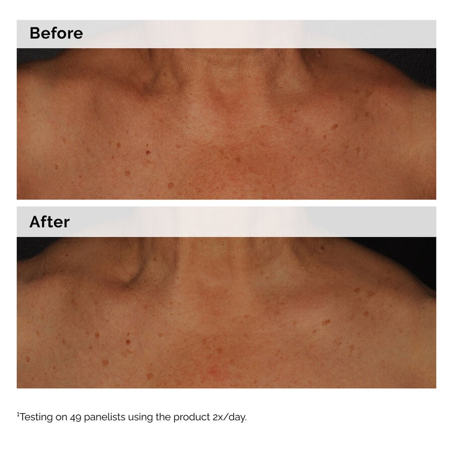 niacinamide-5-face-and-body-emulsion-t0 2024-08-23-ORD-Nia-5pct-Face-Body-B-A-Global-02-1x1.jpg