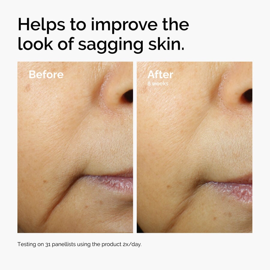 caffeine-3-escin-1-face-serum-k6 ord-caffeine-3pct-escin-1pct-face-serum-before-after-sagging.jpg