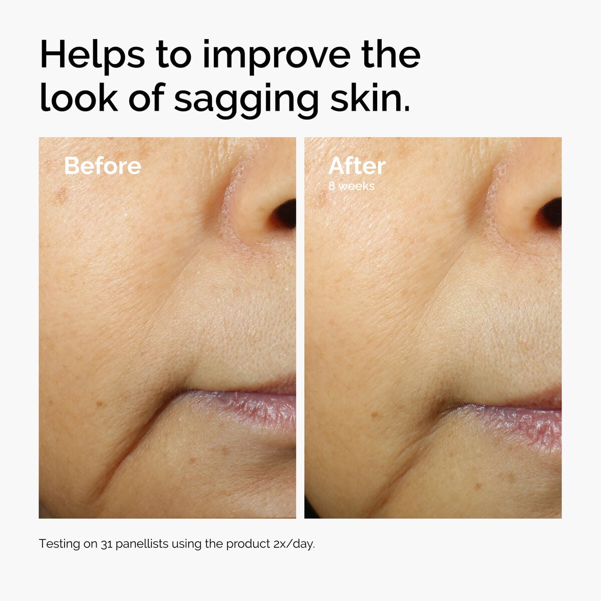 caffeine-3-escin-1-face-serum-k6 ord-caffeine-3pct-escin-1pct-face-serum-before-after-sagging.jpg