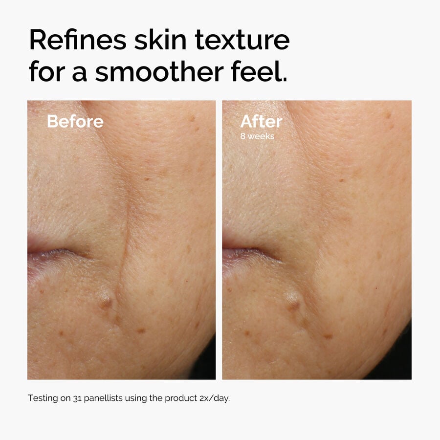 caffeine-3-escin-1-face-serum-k6 ord-caffeine-3pct-escin-1pct-face-serum-before-after-texture.jpg