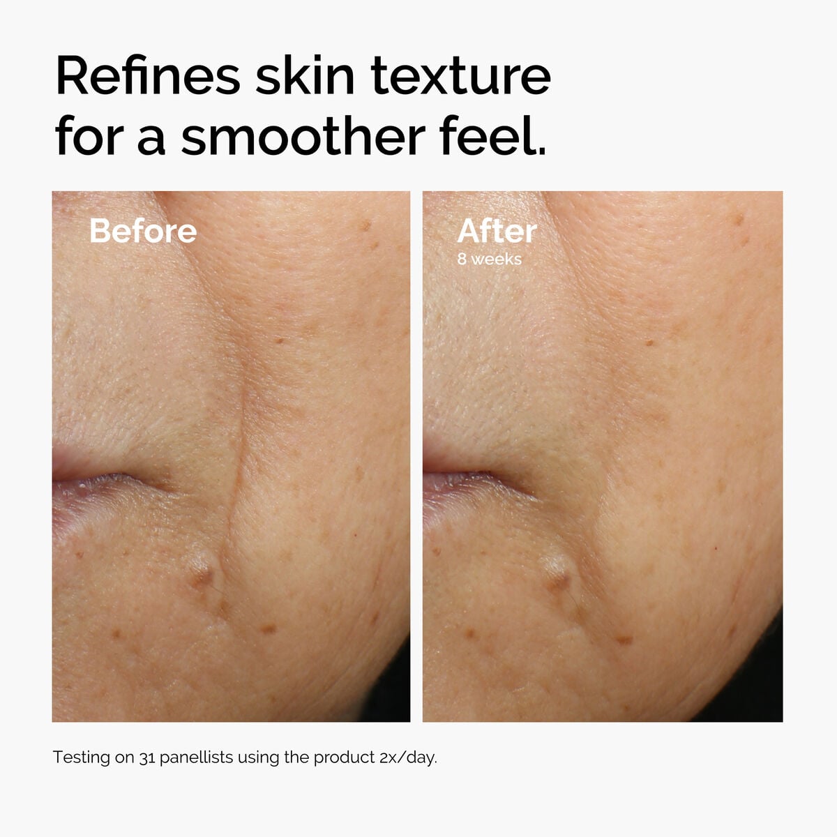 caffeine-3-escin-1-face-serum-k6 ord-caffeine-3pct-escin-1pct-face-serum-before-after-texture.jpg