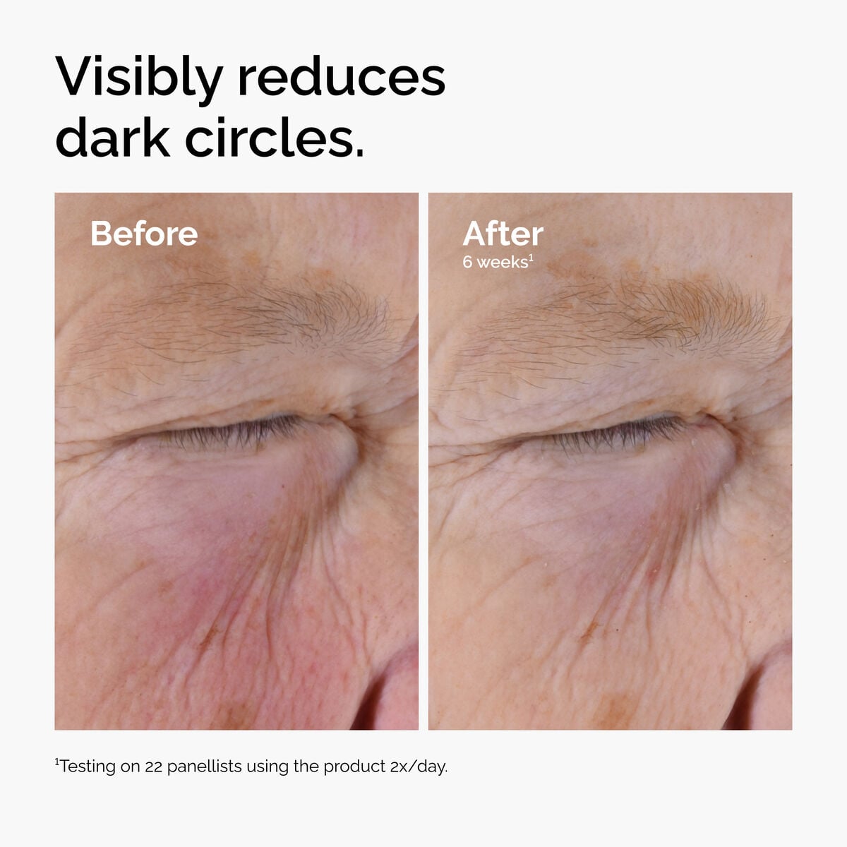 caffeine-solution-5-egcg-eye-serum-o5 ord-caffeine-solution-egcg-dark-circles-before-after.jpg