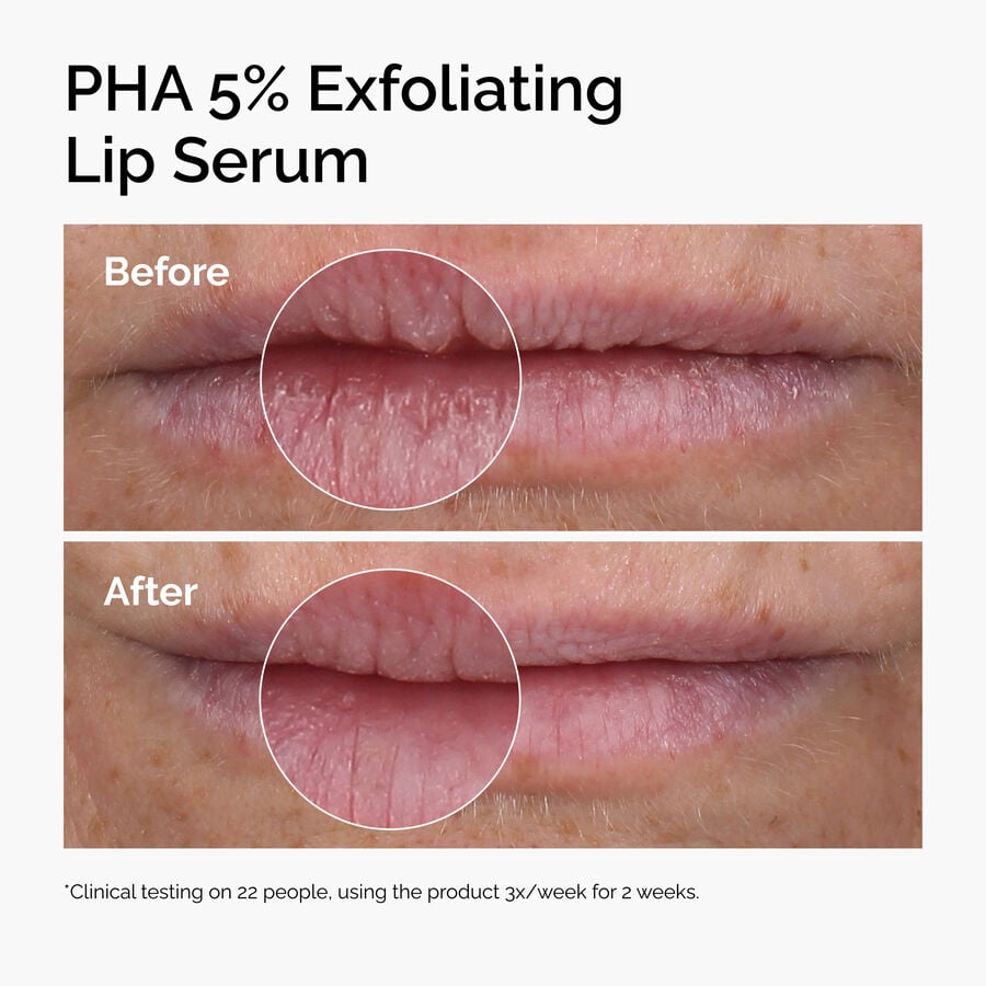 pha-5-exfoliating-lip-serum-w4 ord-pha-5pct-lip-exfoliating-serum-before-after.jpg