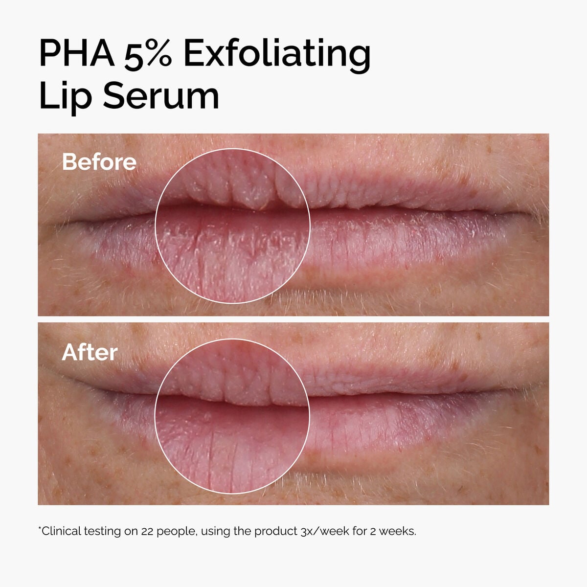 pha-5-exfoliating-lip-serum-w4 ord-pha-5pct-lip-exfoliating-serum-before-after.jpg